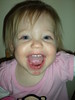 SmugMug > all-time keyword > about > fat lip...day 2